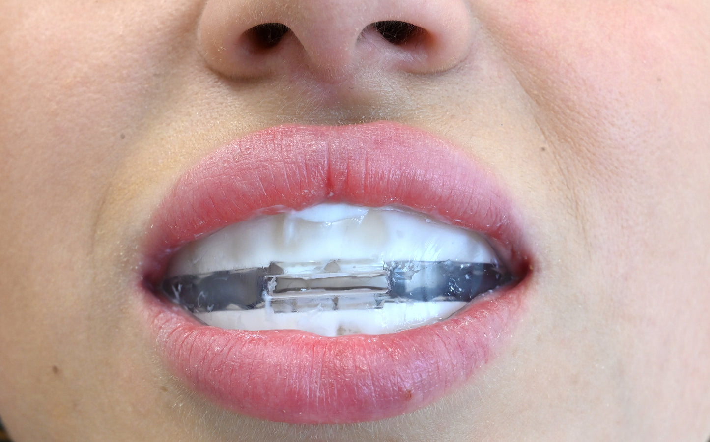 ApaCare Skinna
