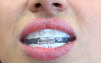 ApaCare Skinna