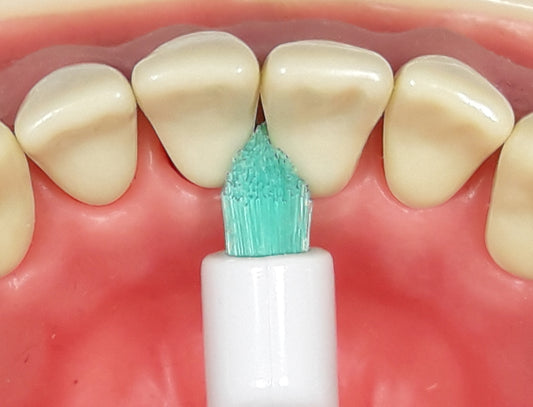 ApaCare Sonic Millitannabursti (aukahausar)